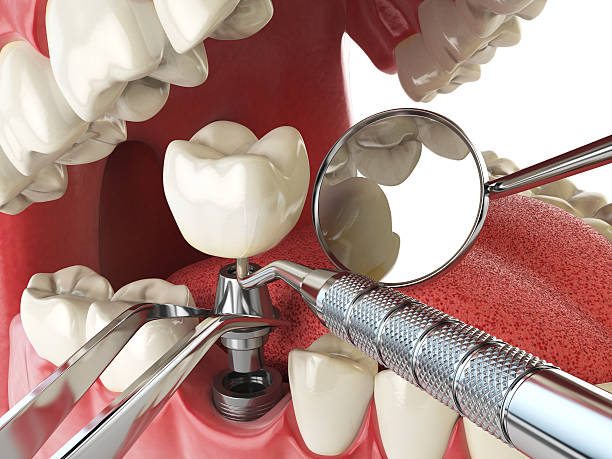 Best Emergency Tooth Extraction in East Uniontown, PA